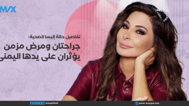 تفاصيل حالة اليسا الصحية: جراحتان ومرض مزمن يؤثران على يدها اليمنى