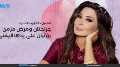 تفاصيل حالة اليسا الصحية: جراحتان ومرض مزمن يؤثران على يدها اليمنى