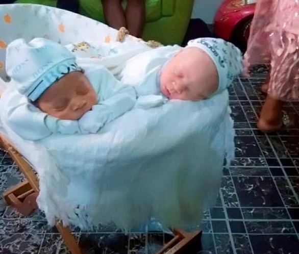 توأم أبيض وأسمر يثير الدهشة: حالة نادرة في نيجيريا توأم أبيض وأسمر يثير الدهشة: حالة نادرة في نيجيريا