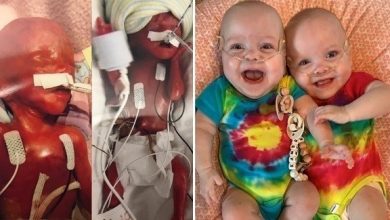 أصغر طفلتين توأم تحتفلان بعيد ميلادهما الأول التوأم كيلي وكامبري إيوولدت