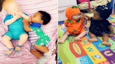 توأم أبيض وأسمر يثير الدهشة: حالة نادرة في نيجيريا توأم أبيض وأسمر يثير الدهشة: حالة نادرة في نيجيريا