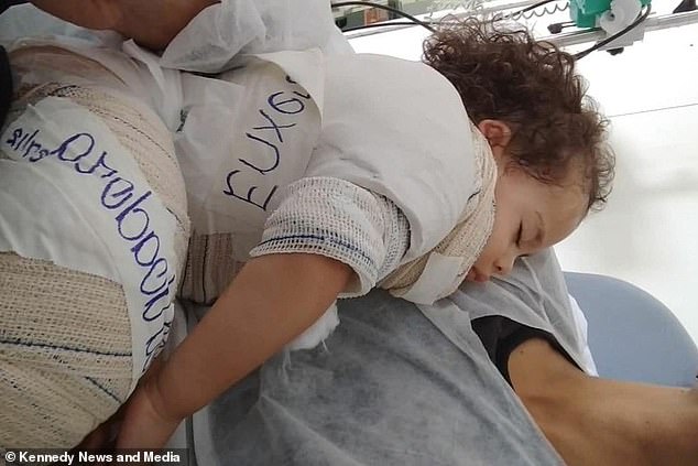 لاصق "سوبر غلو" يُحول جسد طفل إلى كتلة لهب لاصق "سوبر غلو" يُحول جسد طفل إلى كتلة لهب