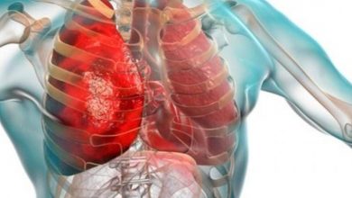 منظمة الصحة العالمية تتابع ارتفاع عدوى الالتهاب الرئوي منظمة الصحة العالمية تتابع ارتفاع عدوى الالتهاب الرئوي