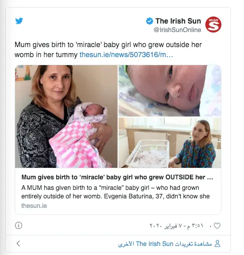 ولادة طفلة معجزة نمت خارج رحم أمها ولادة طفلة معجزة نمت خارج رحم أمها