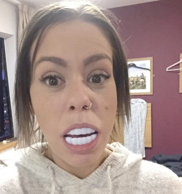 اشترت أسناناً صناعية من أمازون وهذا ما حصلت عليه اشترت أسناناً صناعية من أمازون وهذا ما حصلت عليه