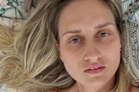 عروس تعاني من حالة نادرة تجعلها تشعر بالغرق تؤجل زفافها بانتظار العلاج عروس تعاني من حالة نادرة تجعلها تشعر بالغرق تؤجل زفافها بانتظار العلاج