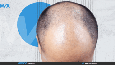 لصاقة ثورية تساعد على علاج الصلع وإعادة نمو الشعر لصاقة ثورية تساعد على علاج الصلع وإعادة نمو الشعر