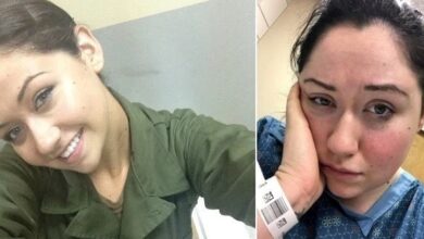 حساسية الجاذبية: امرأة تعاني من متلازمة نادرة تجعلها محبوسة في السرير حساسية الجاذبية: امرأة تعاني من متلازمة نادرة تجعلها محبوسة في السرير