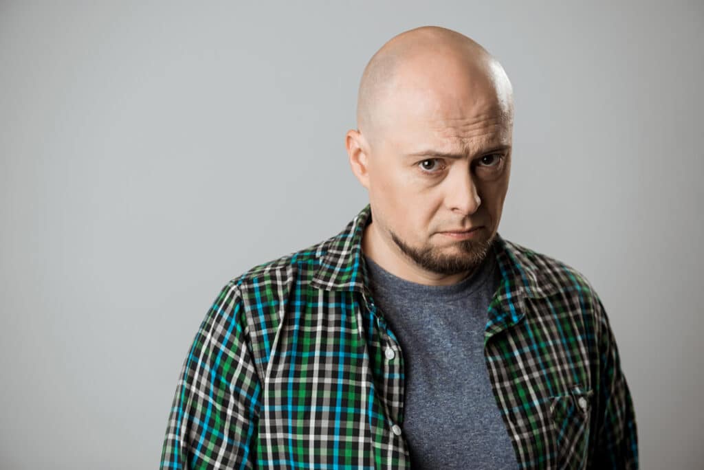 الصلع الوراثي لدى الرجال: أسبابه وطرق العلاج المتاحة الصلع الوراثي لدى الرجال: أسبابه وطرق العلاج المتاحة