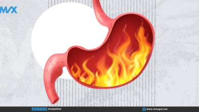 حرقة المعدة: أسبابها وأفضل الطرق لتخفيفها والوقاية منها حرقة المعدة: أسبابها وأفضل الطرق لتخفيفها والوقاية منها